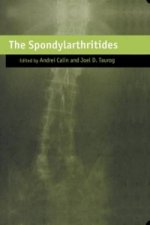 Spondylarthritides