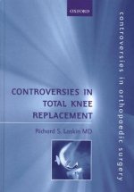 Controversies in Total Knee Replacement