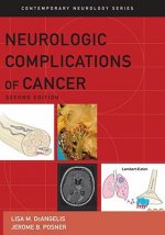 Neurologic Complications of Cancer