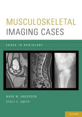 Musculoskeletal Imaging Cases (Mark W. Anderson,Stacy E. Smith)(Brožovaná)