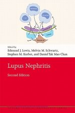 Lupus Nephritis
