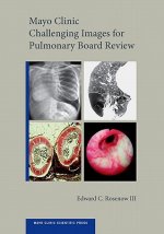 Mayo Clinic Challenging Images for Pulmonary Board Review