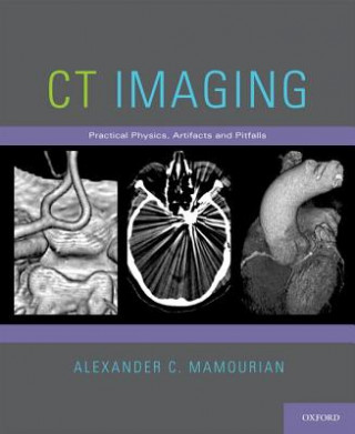 CT Imaging