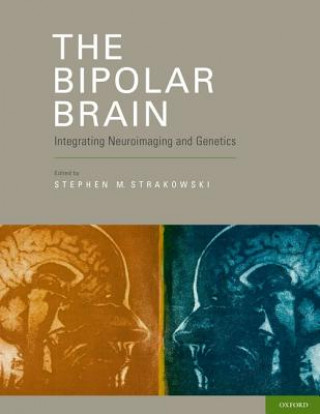 Bipolar Brain