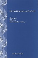 Xenotransplantation