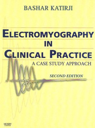 Electromyography in Clinical Practice