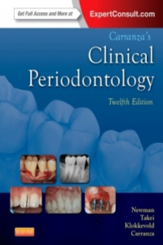 Carranza's Clinical Periodontology