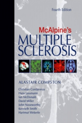 McAlpine's Multiple Sclerosis