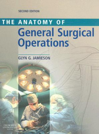 Anatomy of General Surgical Operations