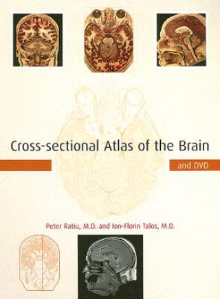Cross-sectional Atlas of the Brain and DVD