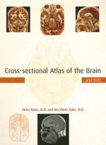 Cross-sectional Atlas of the Brain and DVD