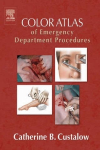 Color Atlas of Emergency Department Procedures