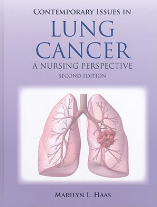 Contemporary Issues In Lung Cancer
