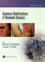 Cutaneous Manifestations of Rheumatic Diseases