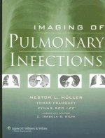 Imaging of Pulmonary Infections