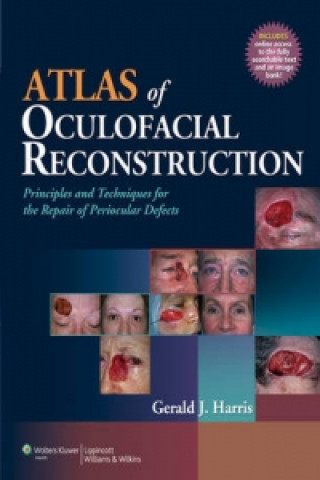 Atlas of Oculofacial Reconstruction