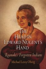 Head in Edward Nugent's Hand