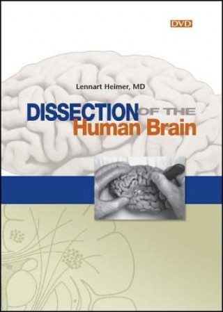 Dissection of the Human Brain