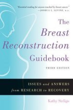 Breast Reconstruction Guidebook