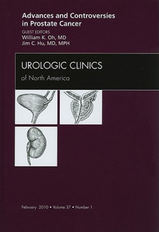 Advances and Controversies in Prostate Cancer, An Issue of Urologic Clinics