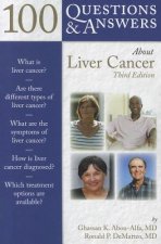 100 Questions  &  Answers About Liver Cancer