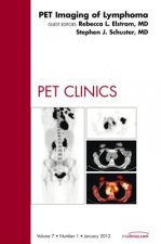 PET Imaging of Lymphoma, An Issue of PET Clinics