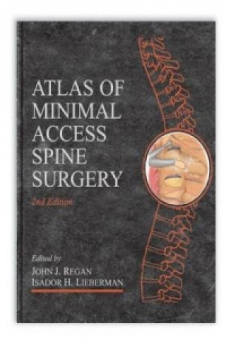 Atlas of Minimal Access Spine Surgery