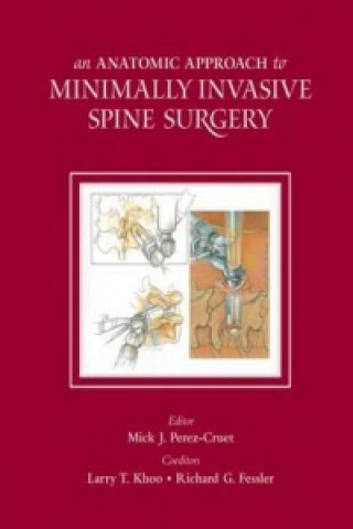 Anatomic Approach to Minimally Invasive Spine Surgery