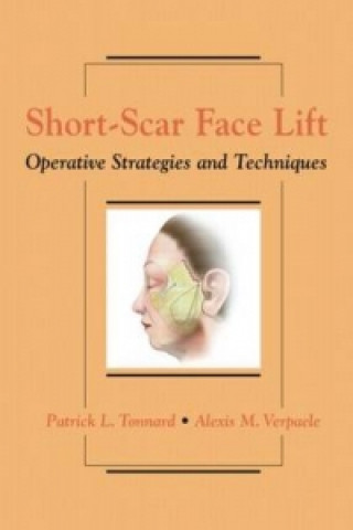 Short-Scar Face Lift