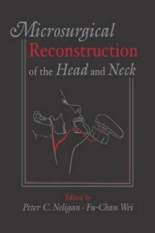 Microsurgical Reconstruction of the Head and Neck