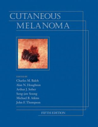 Cutaneous Melanoma, Fifth Edition