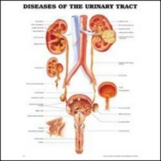 Diseases of the Urinary Tract Anatomical Chart