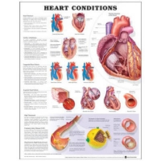 Heart Conditions