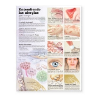 Understanding Allergies Anatomical Chart in Spanish (Entendiendo Las Alergias)