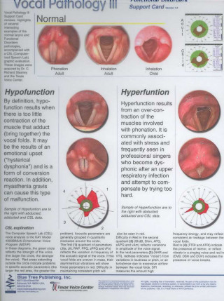 Vocal Pathology