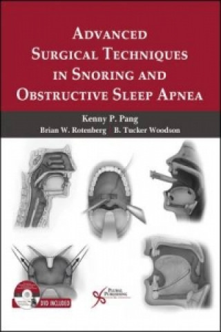 Advanced Surgical Techniques in Snoring and Obstructive Sleep Apnea