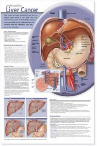 Understanding Liver Cancer Anatomical Chart