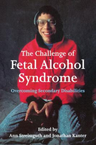 Challenge of Fetal Alcohol Syndrome