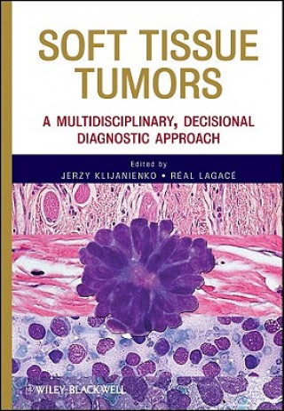 Soft Tissue Tumors - A Multidisciplinary, Decisional Diagnostic Approach