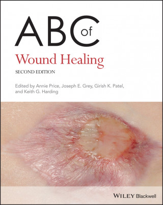 ABC of Wound Healing 2nd Edition