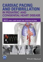 Cardiac Pacing and Defibrillation in Pediatric and  Congenital Heart Disease