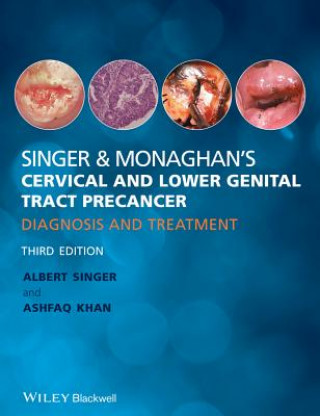 Singer & Monaghan's Cervical and Lower Genital Tract Precancer - Diagnosis and Treatment 3e