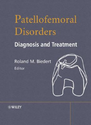 Patellofemoral Disorders - Diagnosis and Treatment