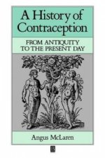 History of Contraception - From Antiquity to the Present Day