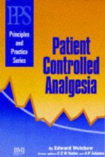 Patient Controlled Analgesia - Principles and Practice Series