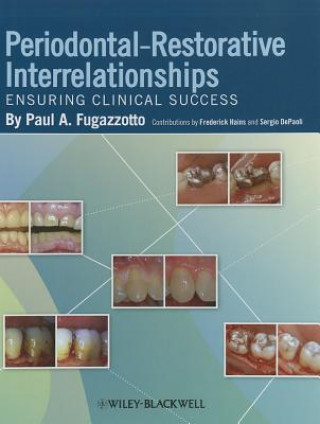 Periodontal-Restorative Interrelationships - Ensuring Clinical Success