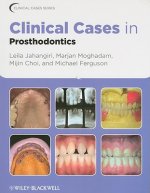 Clinical Cases in Prosthodontics