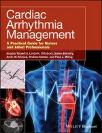 Cardiac Arrhythmia Management - A Practical Guide for Nurses and Allied Professionals