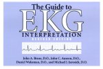 Guide to EKG Interpretation