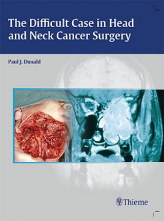 Difficult Case in Head and Neck Cancer Surgery